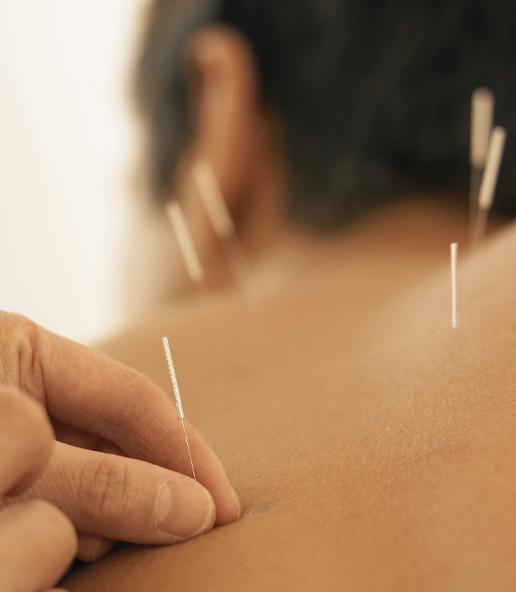 equilibriointegral_acupuntura_21